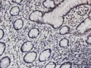 H00010336-M03 - PCGF3 / RNF3
