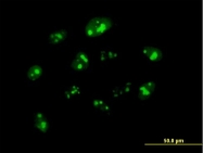 H00010360-B01P - Nucleoplasmin 3
