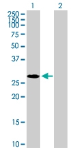 H00010361-B01P - Nucleoplasmin 2