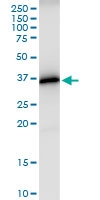 H00010362-D01 - SMARCE1-related protein
