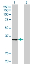 H00010362-D01P - SMARCE1-related protein