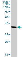 H00010362-D01P - SMARCE1-related protein