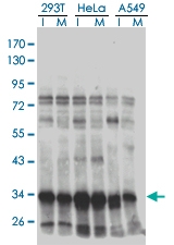 H00010362-M01 - SMARCE1-related protein