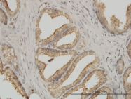 H00010376-M01 - alpha Tubulin / TUBA1B