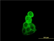 H00010376-M01 - alpha Tubulin / TUBA1B