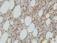 H00010379-M02 - IRF9 / ISGF3G