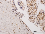 H00010420-M04 - TESK2
