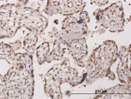 H00010420-M08 - TESK2