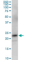 H00010424-M03 - PGRMC2