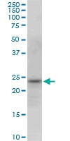 H00010424-M03 - PGRMC2