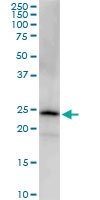 H00010424-M03 - PGRMC2