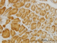 H00010424-M04 - PGRMC2