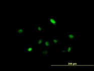 H00010425-B01P - ARIH2 / TRIAD1