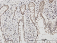 H00010438-M03 - C1D
