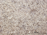 H00010445-B01P - MCRS1
