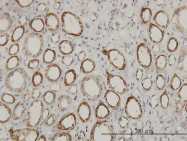 H00010449-M01 - ACAA2