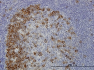 H00010460-M02 - TACC3 / ERIC1