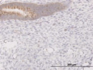 H00010464-M02 - PIBF1