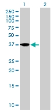 H00010468-B01P - Follistatin