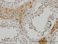 H00010488-M01 - CREB3
