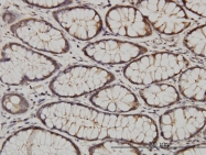 H00010519-M01 - CIB1