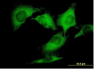 H00010540-B01P - Dynactin subunit 2