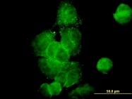 H00010540-M01 - Dynactin subunit 2