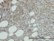 H00010544-M03 - CD201 / EPCR