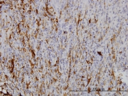 H00010590-M01 - Secretagogin (SCGN)