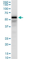 H00010611-A02 - PDLIM5