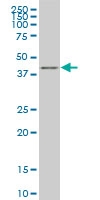 H00010661-M03 - Krueppel-like factor 1 (KLF1)