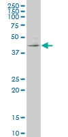 H00010661-M04 - Krueppel-like factor 1 (KLF1)