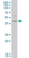 H00010661-M05 - Krueppel-like factor 1 (KLF1)