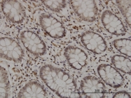 H00010691-M01 - GMEB1