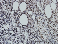 H00010735-M01 - STAG2 / Stromal antigen 2