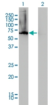 H00010768-M05 - AdoHcyase 2 / AHCYL1