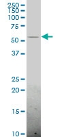 H00010849-A01 - CD3EAP