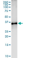H00010953-D01 - TOMM34