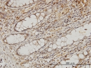 H00010982-M03 - MAPRE2