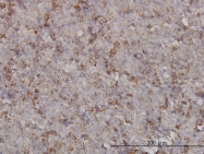 H00011004-M01 - KIF2C