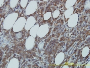 H00011140-M01 - CDC37