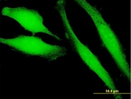 H00011145-B01P - HRAS-like suppressor 3 / HRASLS3