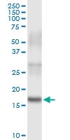 H00011145-D01 - HRAS-like suppressor 3 / HRASLS3