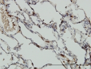 H00011151-M01 - Coronin-1A