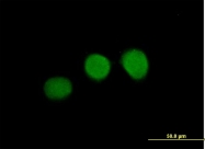 H00011152-B01P - WDR45 / WIPI-4