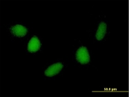 H00011162-B01 - NUDT6 / FGF2AS