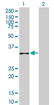 H00011199-B01 - Annexin A10 / ANXA10