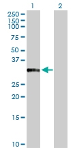 H00011199-D01P - Annexin A10 / ANXA10