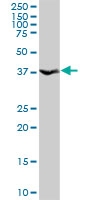 H00011199-D01P - Annexin A10 / ANXA10