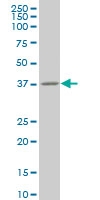 H00011199-M03 - Annexin A10 / ANXA10